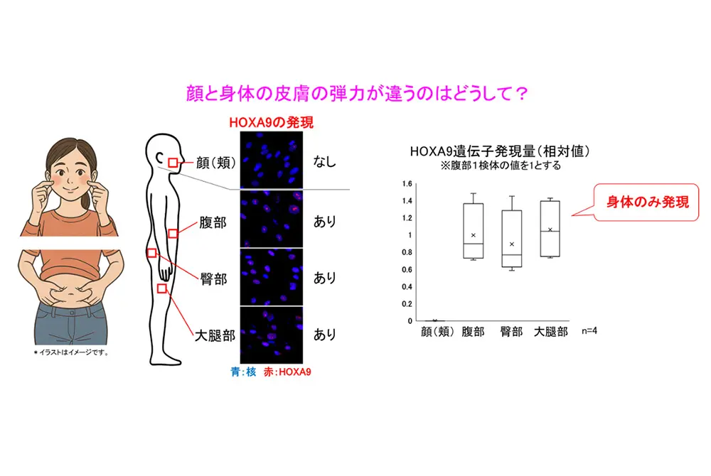 HOXA9の働きが腹部、臀部、大腿部で見られるが、顔ではほとんど見られない。（出典／藤田医科大学）