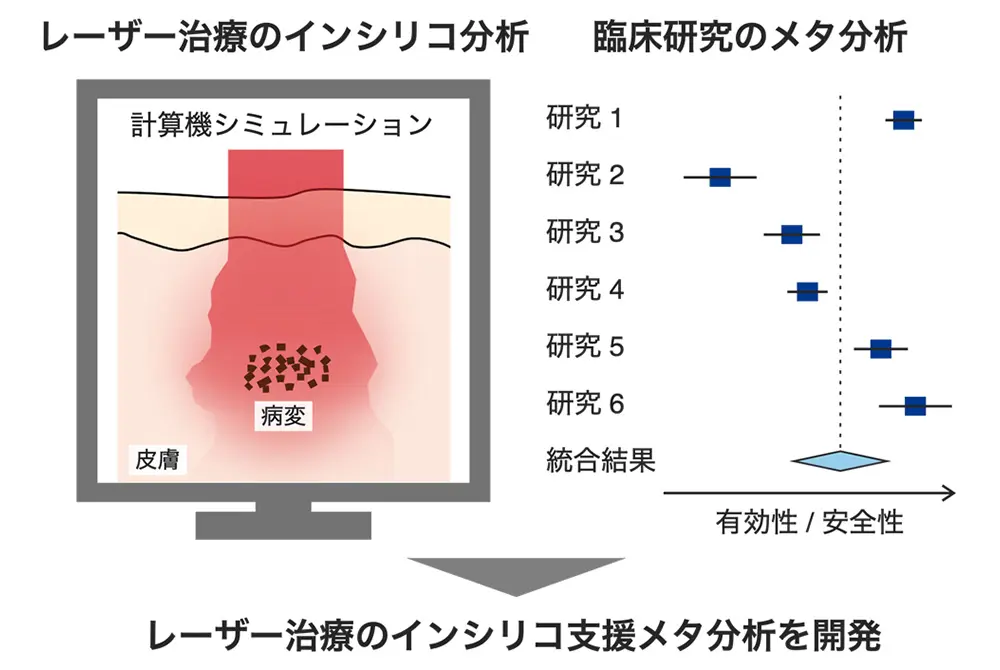 コンピューターによるシミュレーションにより適切なレーザー照射条件の目安を決定。(出典/大阪公立大学)