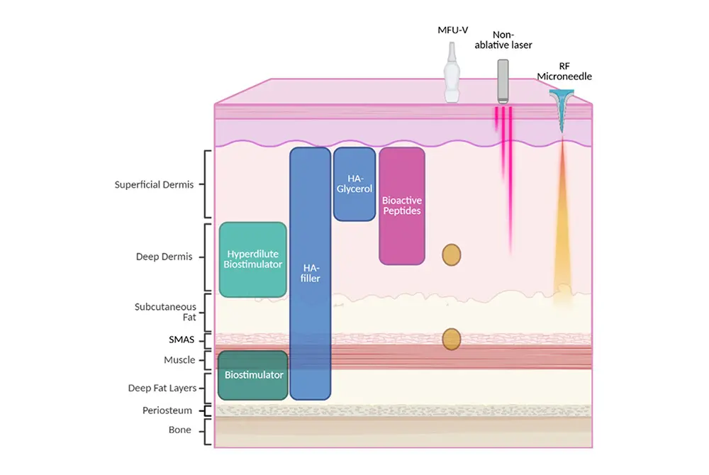 肌の層に合わせた治療選択肢がある。（出典／J Cosmet Dermatol. 2025;24 Suppl 4:e70359.）