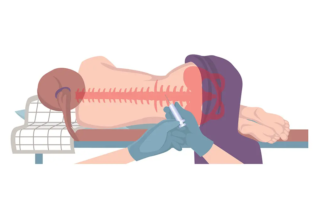 腰椎穿刺により幹細胞を注入した。画像はイメージ。（写真／Adobe Stock）