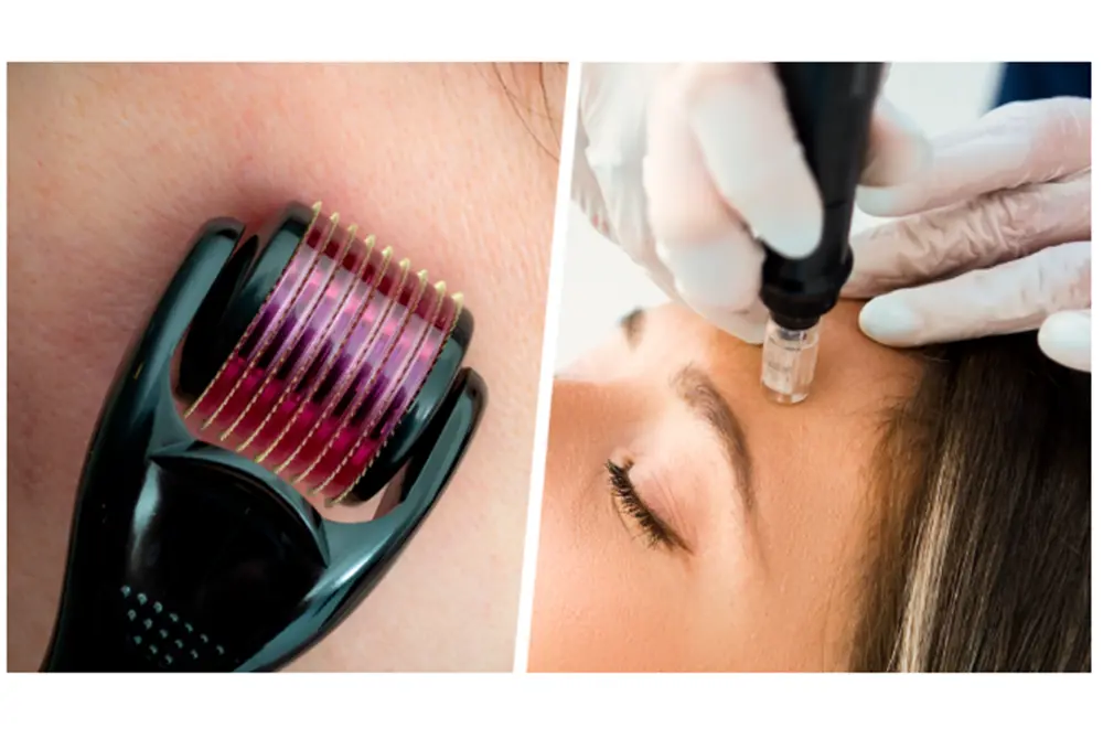 米国食品医薬品局（FDA）がマイクロニードルの市販品に注意喚起。（出典／FDA）