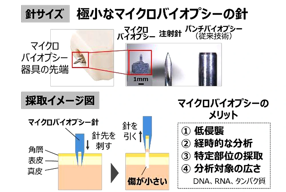 マイクロバイオプシーの極小針のサイズと、皮膚から微量組織を採取する方法を示した図。