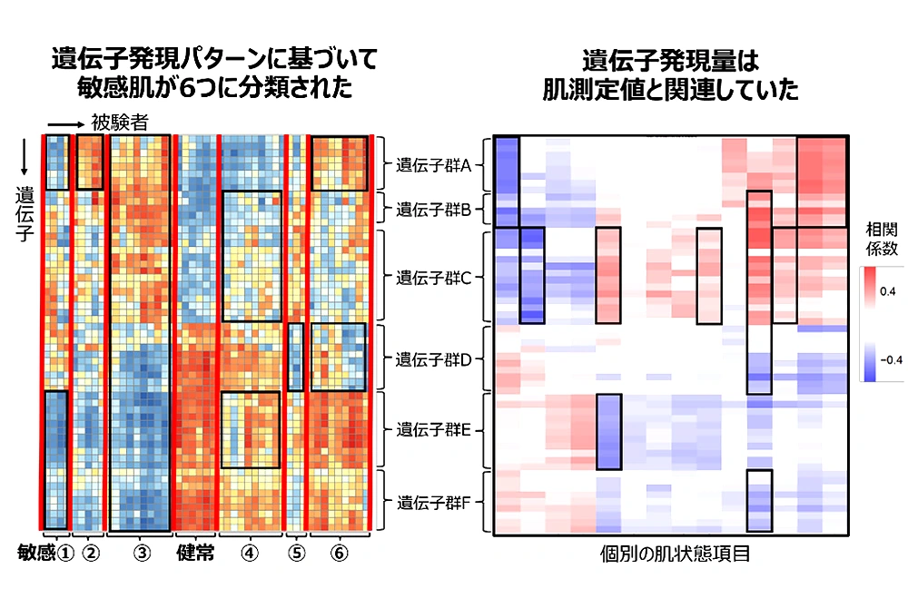 敏感肌が遺伝子発現パターンに基づいて6つに分類され、遺伝子発現量が肌測定値と関連することを示したヒートマップ。
