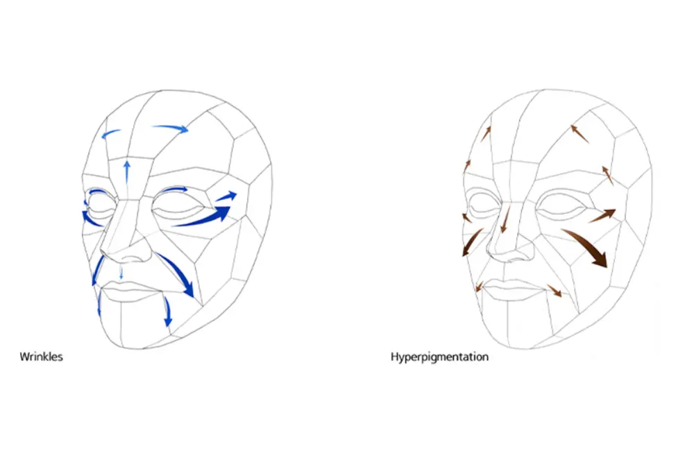 シワと色素沈着が顔のどの方向へ広がるかを、顔の模式図と矢印で示した図。
