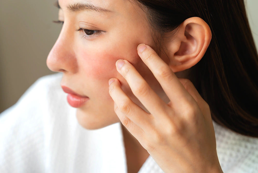 頬の赤みがある部分に指を添え、肌の状態を確認する女性の横顔。