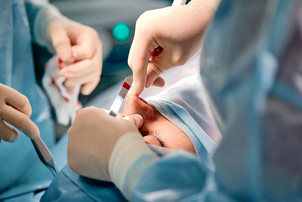 手術室で鼻の処置を受ける患者と、器具を持つ医療従事者の手元。