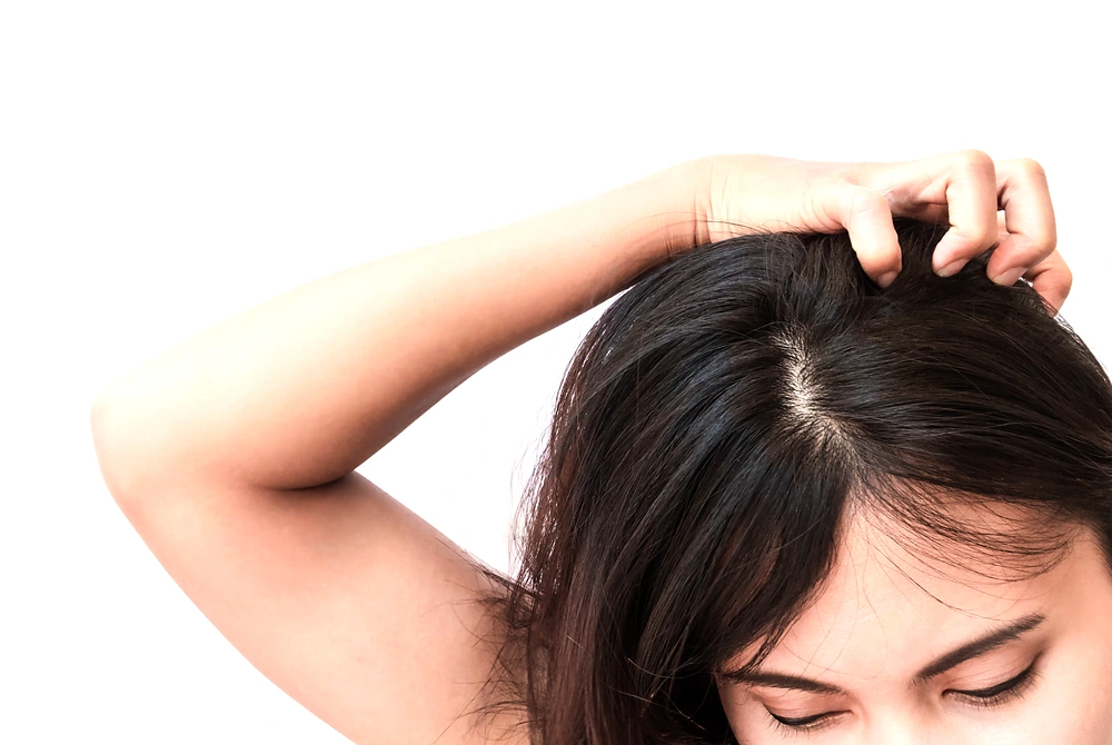 女性が片手で頭頂部の髪をかき分け、頭皮を触っている様子。