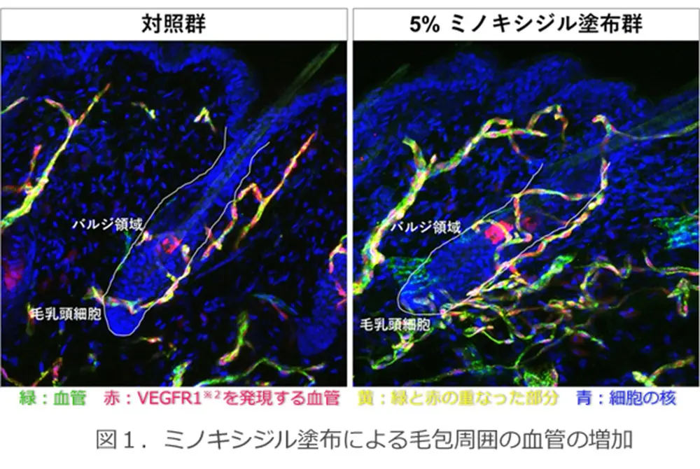 右の方が緑色の血管が増えている。（出典／大正製薬）