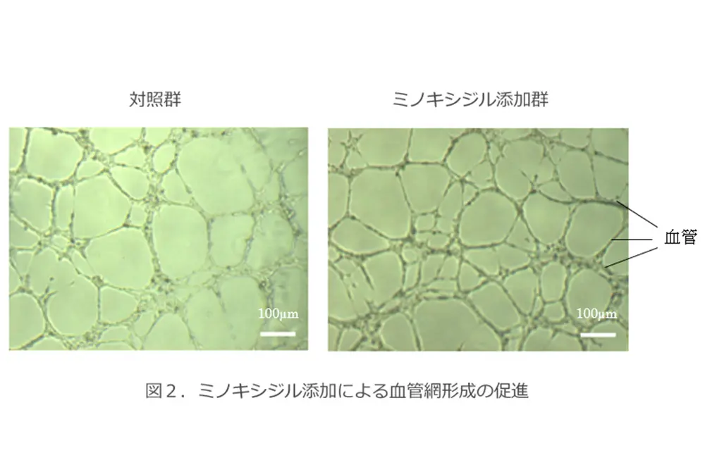 右の方が血管網が増えている。（出典／大正製薬）