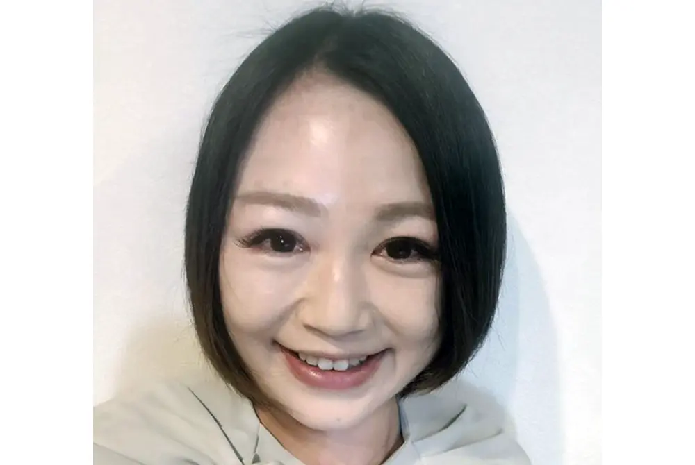 脂肪吸引のトラブル以前、数カ月以内の写真。（写真提供／瀬戸麻希さん）