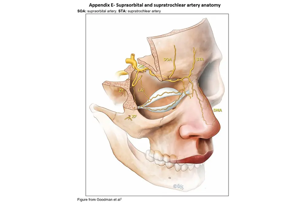 黄色く示されているのが血管。目の周りに血管が走っている。ここにフィラー製剤が入り、目の後ろの血管の方で詰まると、視力に影響すると考えられる。(出典/RANZCO Guideline for Filler Blindness)