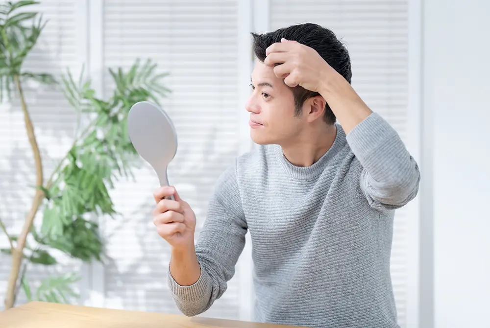 毛量が減る男性型脱毛症（AGA）。写真はイメージ。（写真／Adobe Stock）