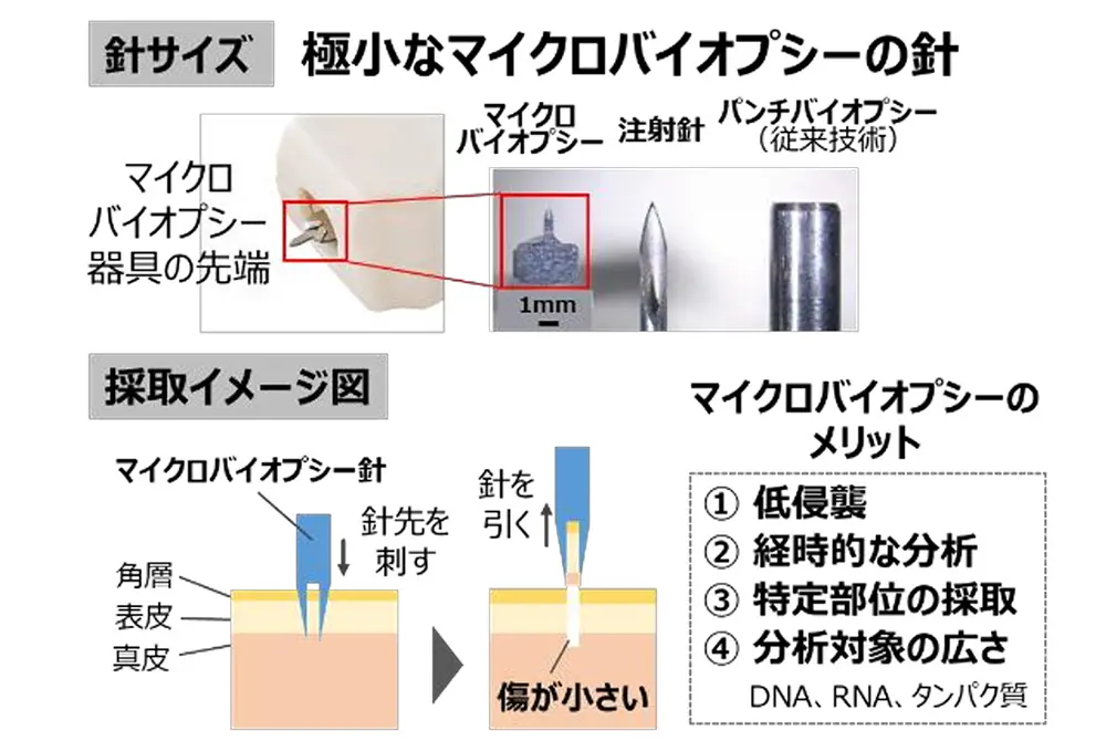 マイクロバイオプシーで皮膚細胞を採取。（出典／ポーラ化成工業）