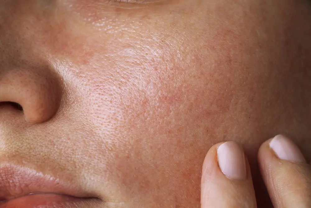 毛包の幹細胞が皮膚の治癒を促す役割も。画像はイメージ。（写真／Adobe Stock）