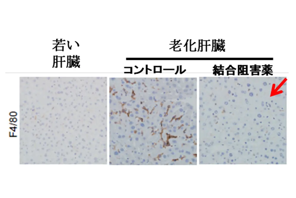 左端は若い肝臓。右2つは老化した肝臓。処理を行った右側は若い肝臓と同じような見た目をしている。（出典／京都大学）