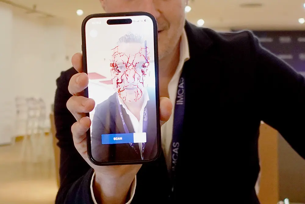 データベースに保存された血管の走り方を示すデータに基づいて、画面の顔の上に血管を映し出す。画面の顔はヘンドリクス氏だが、血管の形は保存されたデータ通りの形になっている。（写真／編集部）