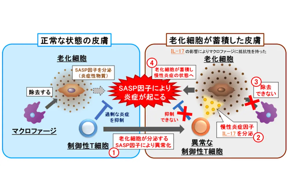 Tregが関与する肌老化のメカニズム。（出典／藤田医科大学）