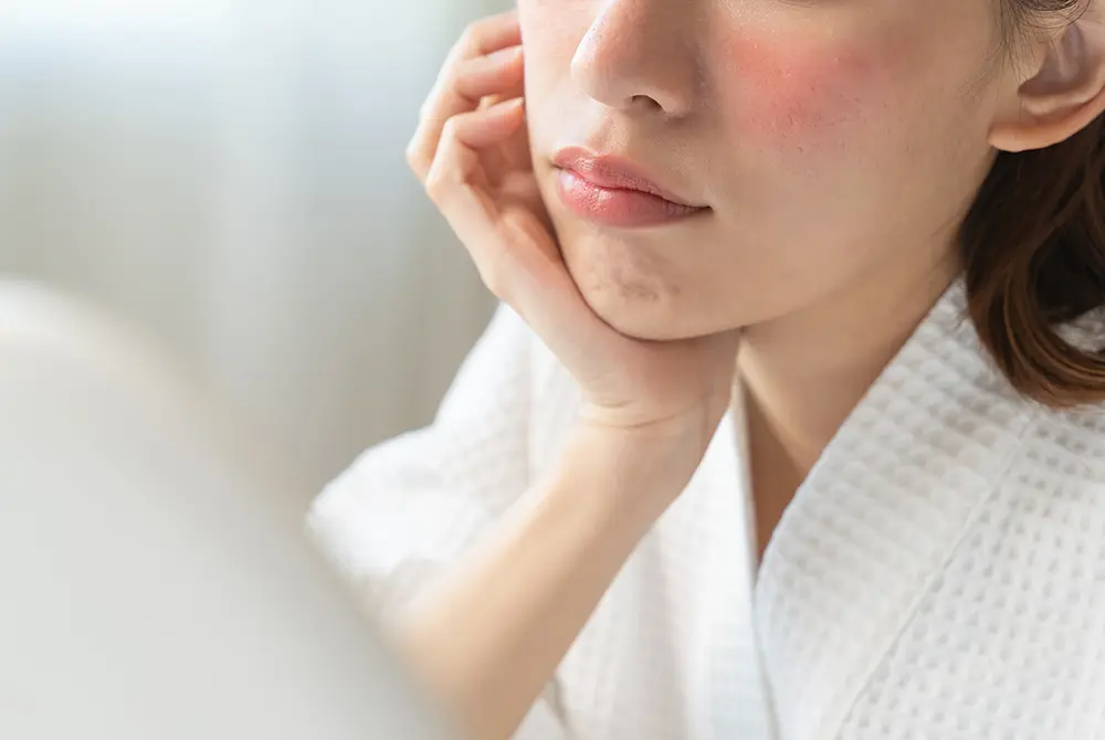 赤ら顔は美容の課題にも。画像はイメージ。（写真／Adobe Stock）