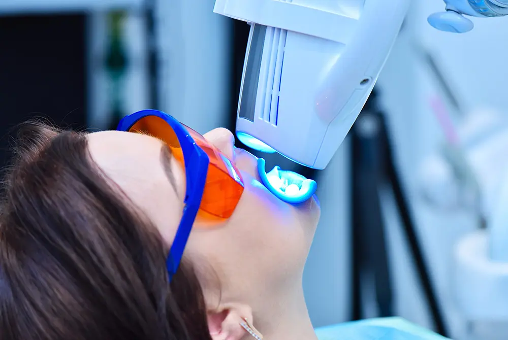 審美歯科では、ホワイトニングが注目される。画像はイメージ。（写真：Adobe Stock）
