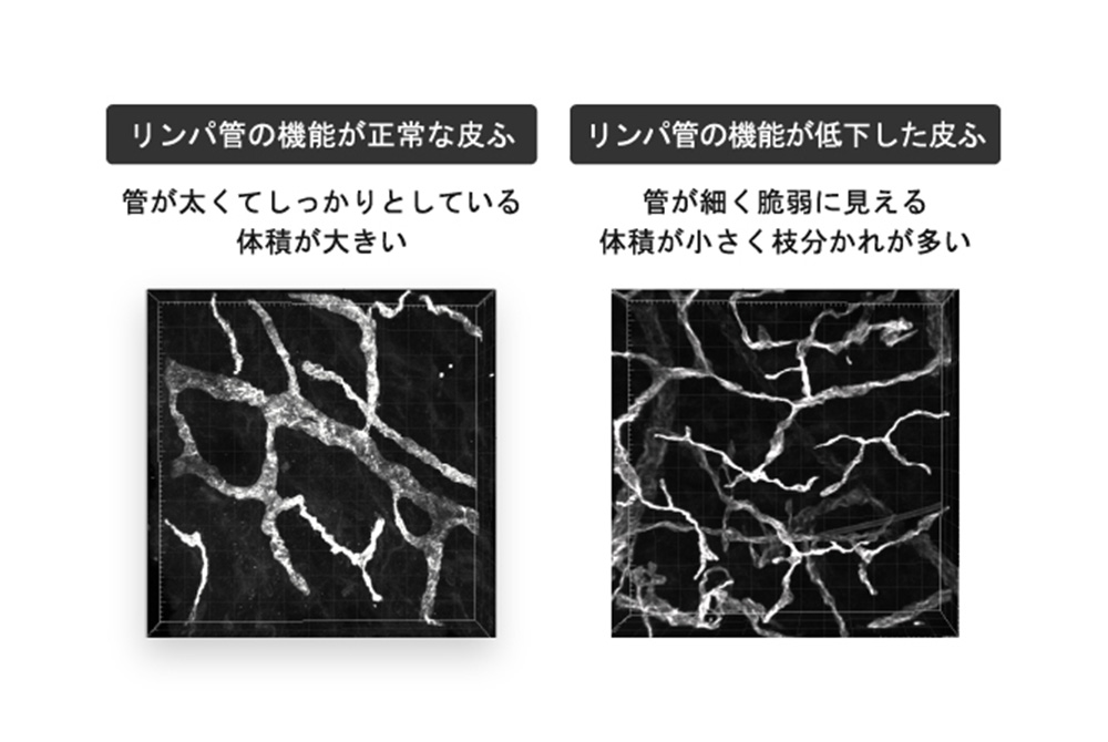 毛細リンパ管を3次元画像で確認可能に。（出典／資生堂）