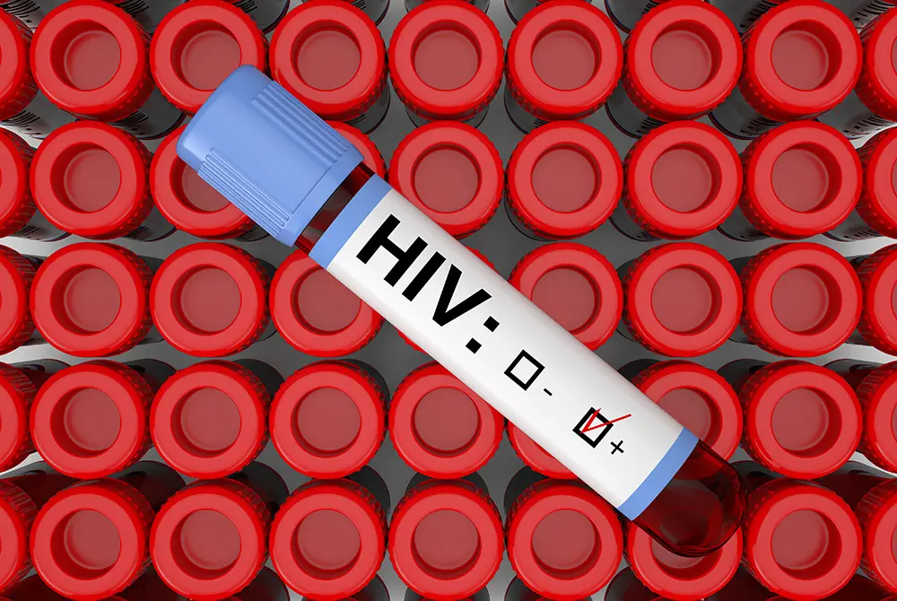 針を通してHIV感染が広がった可能性がある。写真はイメージ。（写真／Adobe Stock）