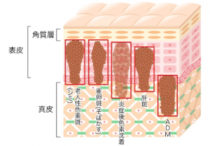 スペクトラ Ls 詳細情報 美容ヒフコ