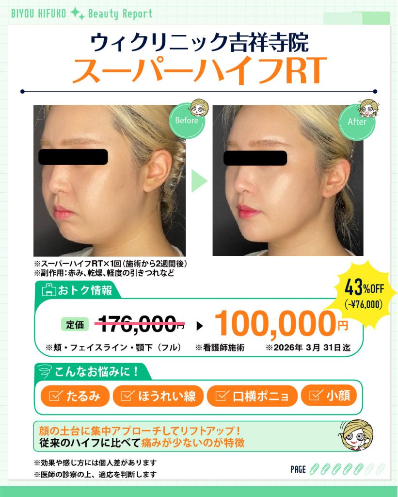 ウィクリニック,美容ヒフコ,スーパーハイフ,ハイフ