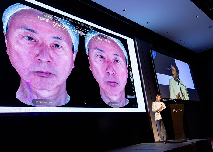 AURA,肌診断機,牧野良彦先生