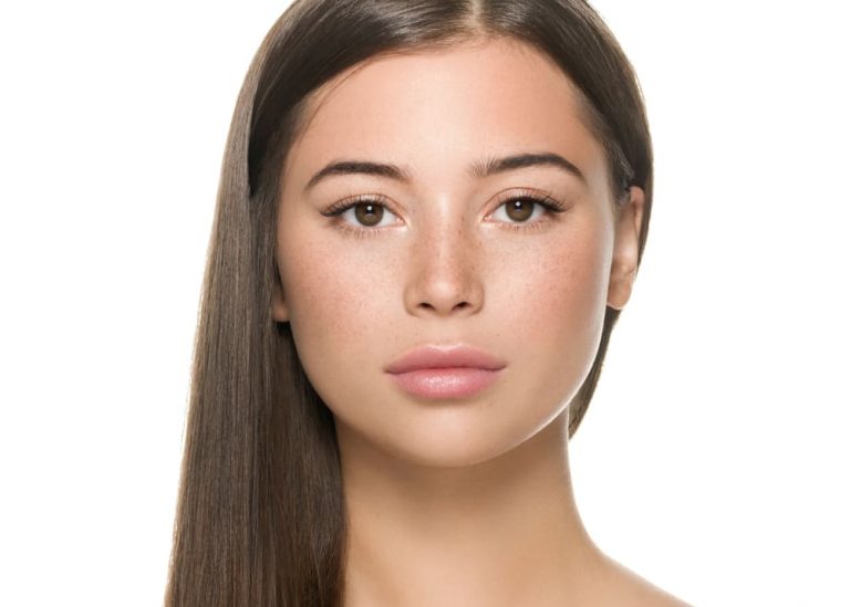 そばかす,消したい