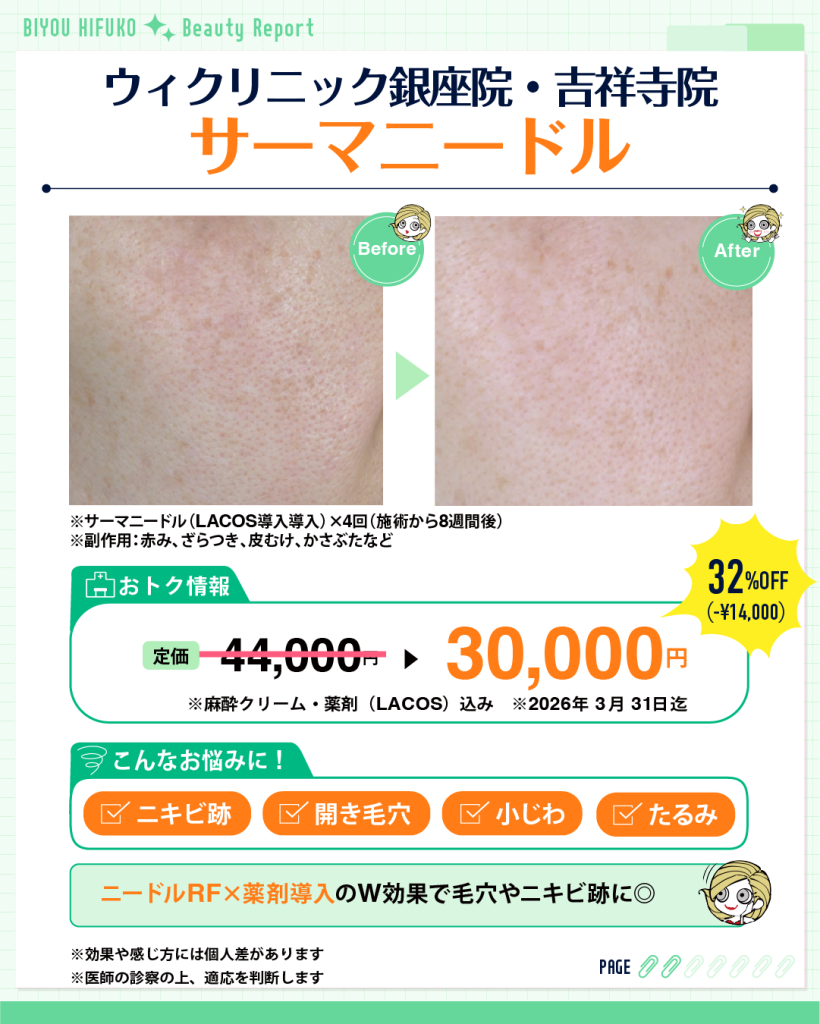 ウィクリニック,美容ヒフコ,サーマニードル