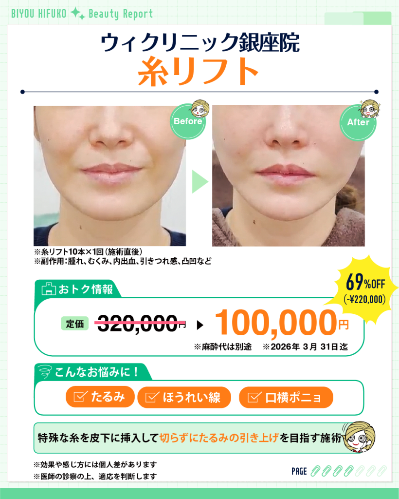ウィクリニック,美容ヒフコ,糸リフト